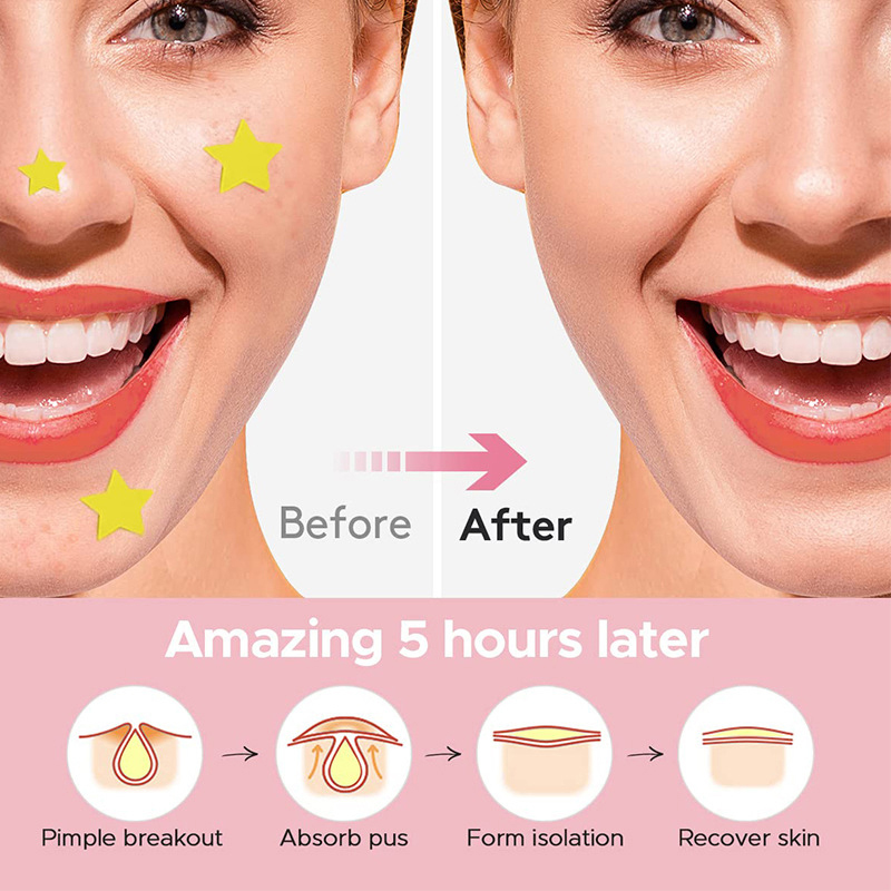 600 PCS/Set Star Pimple Patch  - Beauty Makeup Face reseña y precio